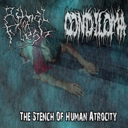 Condiloma : The Stench of Human Atrocity